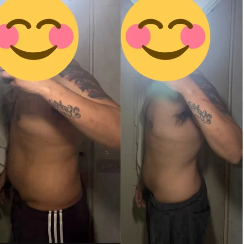 Resultado antes y después de rebajar barriga en hombres con Aitor Arrazola
