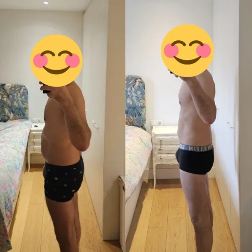 Transformación de un paciente: resultados de dieta para adelgazar con Aitor Arrazola